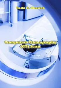 "Computed-Tomography (CT) Scan" ed. by Reda R. Gharieb