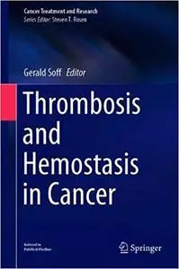 Thrombosis and Hemostasis in Cancer