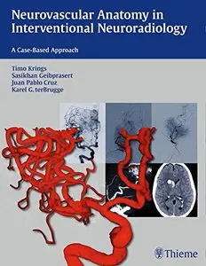 Neurovascular Anatomy in Interventional Neuroradiology: A Case-Based Approach