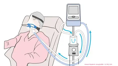 Just Breathe 101 Diaphragm in Critical Care