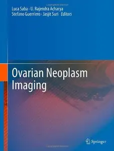 Ovarian Neoplasm Imaging (repost)