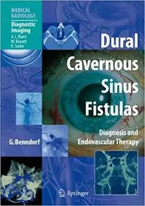 Dural Cavernous Sinus Fistulas: Diagnosis and Endovascular Therapy (Repost)