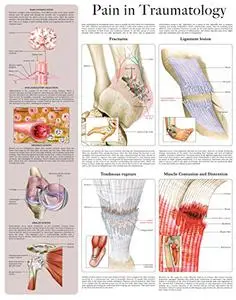 Pain in Traumatology e-chart: Quick reference guide