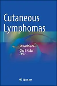 Cutaneous Lymphomas: Unusual Cases 3