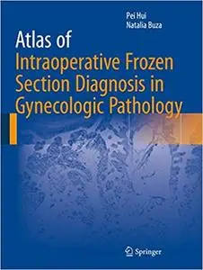 Atlas of Intraoperative Frozen Section Diagnosis in Gynecologic Pathology