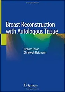 Breast Reconstruction with Autologous Tissue