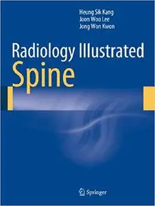 Radiology Illustrated: Spine (Repost)