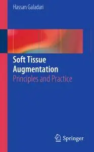 Soft Tissue Augmentation: Principles and Practice