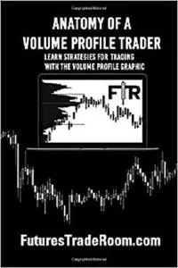 Anatomy of a Volume Profile Trader: Learn tips and strategies for trading the Volume Profile