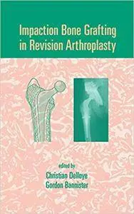 Impaction Bone Grafting in Revision Arthroplasty