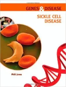 Sickle Cell Disease (Genes and Disease) (repost)