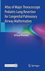 Atlas of Major Thoracoscopic Pediatric Lung Resection for Congenital Pulmonary Airway Malformation