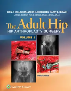 The Adult Hip: Hip Arthroplasty Surgery (3rd Edition)