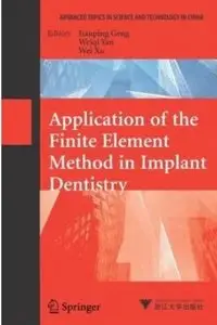 Application of the Finite Element Method in Implant Dentistry [Repost]
