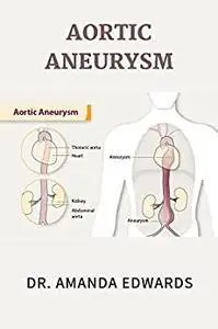 AORTIC ANEURYSM : Signs, Symptoms