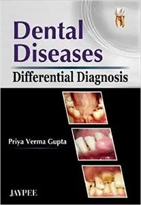 Dental Diseases Differential Diagnosis