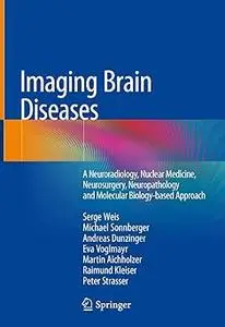 Imaging Brain Diseases (Repost)
