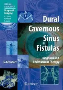 Dural Cavernous Sinus Fistulas: Diagnosis and Endovascular Therapy (Medical Radiology)