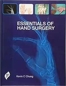 Essentials of Hand Surgery