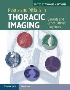 Pearls and Pitfalls in Thoracic Imaging: Variants and Other Difficult Diagnoses