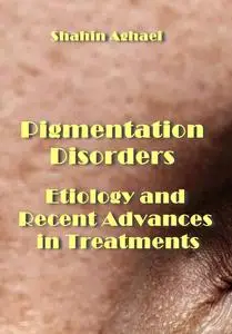 "Pigmentation Disorders: Etiology and Recent Advances in Treatments" ed. by Shahin Aghaei