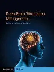 Deep Brain Stimulation Management (Repost)