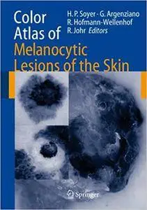 Color Atlas of Melanocytic Lesions of the Skin (Repost)