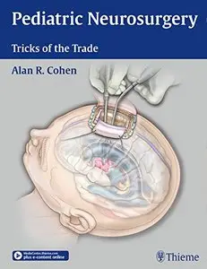 Pediatric Neurosurgery: Tricks of the Trade (repost)