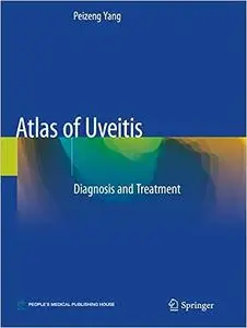 Atlas of Uveitis: Diagnosis and Treatment (Repost)