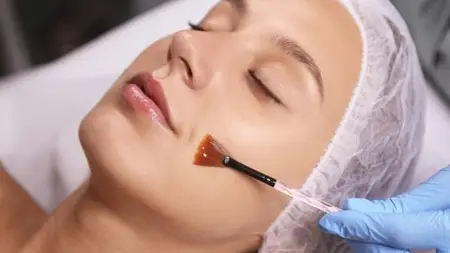 Professional Chemical Peeling Course-Learn 6 Types Of Peels