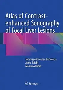 Atlas of Contrast-enhanced Sonography of Focal Liver Lesions (Repost)