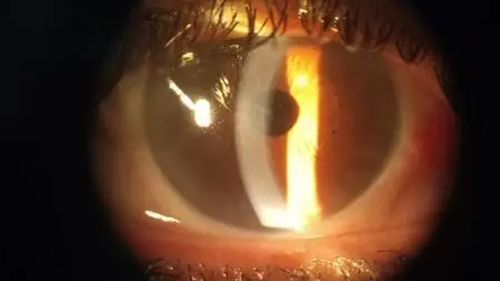A Conceptual Understanding Of Clinical Ophthalmologylogy