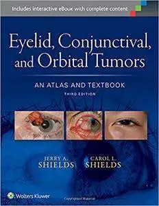 Eyelid, Conjunctival, and Orbital Tumors: An Atlas and Textbook, 3rd edition