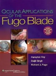 Ocular Applications of the Fugo Blade (repost)