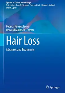 Hair Loss: Advances and Treatments