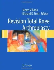 Revision Total Knee Arthroplasty [Repost]