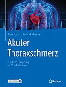 Akuter Thoraxschmerz: EKGs und Bildgebung in 65 Fallbeispielen