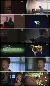 Animal Planet - Monsters Inside Me S02E07: Breeders (2010)