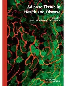 Adipose Tissue in Health and Disease [Repost]
