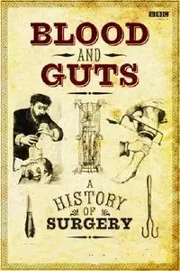 BBC - Blood and Guts A History of Surgery (2009) [Repost]
