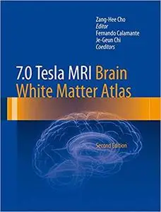 7.0 Tesla MRI Brain White Matter Atlas Ed 2