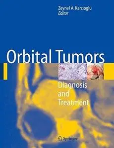 Orbital Tumors: Diagnosis and Treatment