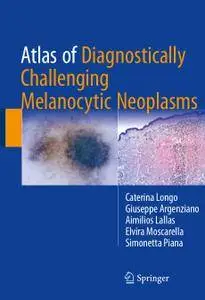 Atlas of Diagnostically Challenging Melanocytic Neoplasms