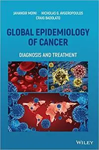 Global Epidemiology of Cancer: Diagnosis and Treatment