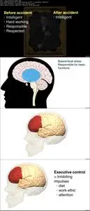 Learn neuroscience: How our brain works in six lectures