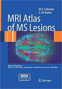 MRI Atlas of MS Lesions (Repost)