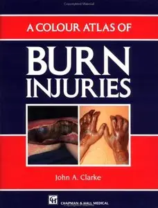 A Colour Atlas of Bone Disease (Wolfe medical atlases)