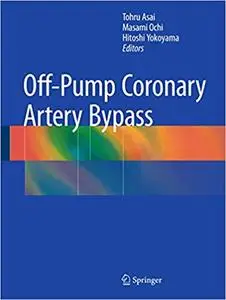 Off-Pump Coronary Artery Bypass (Repost)