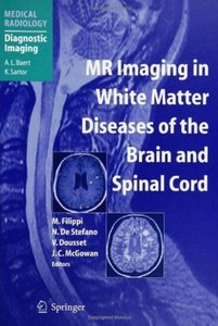 MR Imaging in White Matter Diseases of the Brain and Spinal Cord [Repost]