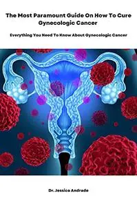 The Most Paramount Guide On How To Cure Gynecologic Cancer